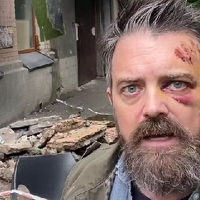 У Подільському районі американський режисер постраждав через обвал балкона (оновлено) - 412x412