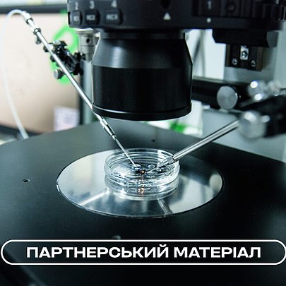 Як збереження жіночої фертильності підвищує шанси на пізнє материнство — пояснює репродуктолог - 412x412