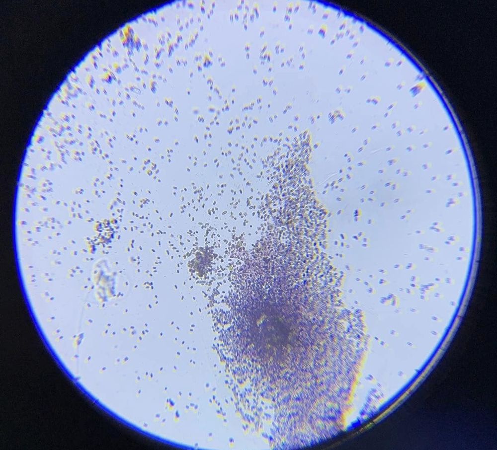 забруднення Совських ставків