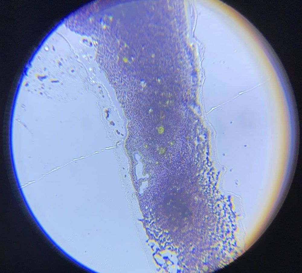 забруднення Совських ставків